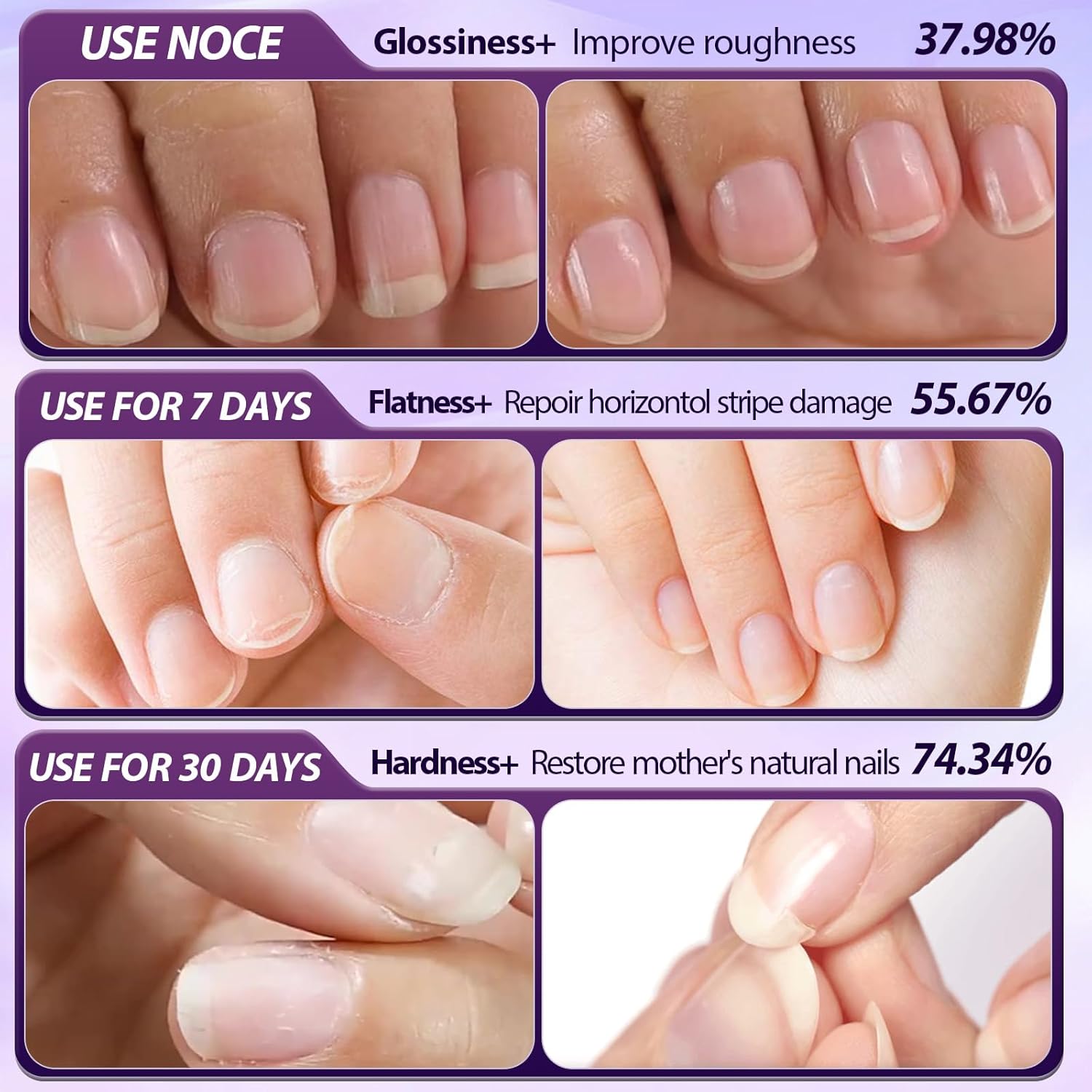 3-in-1 Cuticle Oil Pen,Cuticle Pusher Nail Oil Pen with Ceramic Tip,Dry & Damaged Nails,Nail Cuticle Remover Pen,for Moisturize Strengthen Nails(2PCS) - Image 4